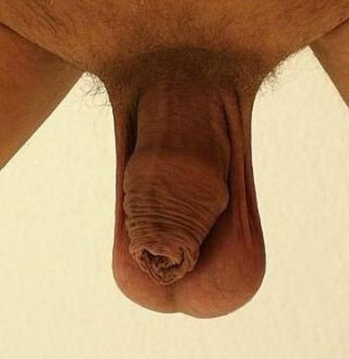 my hanging balls